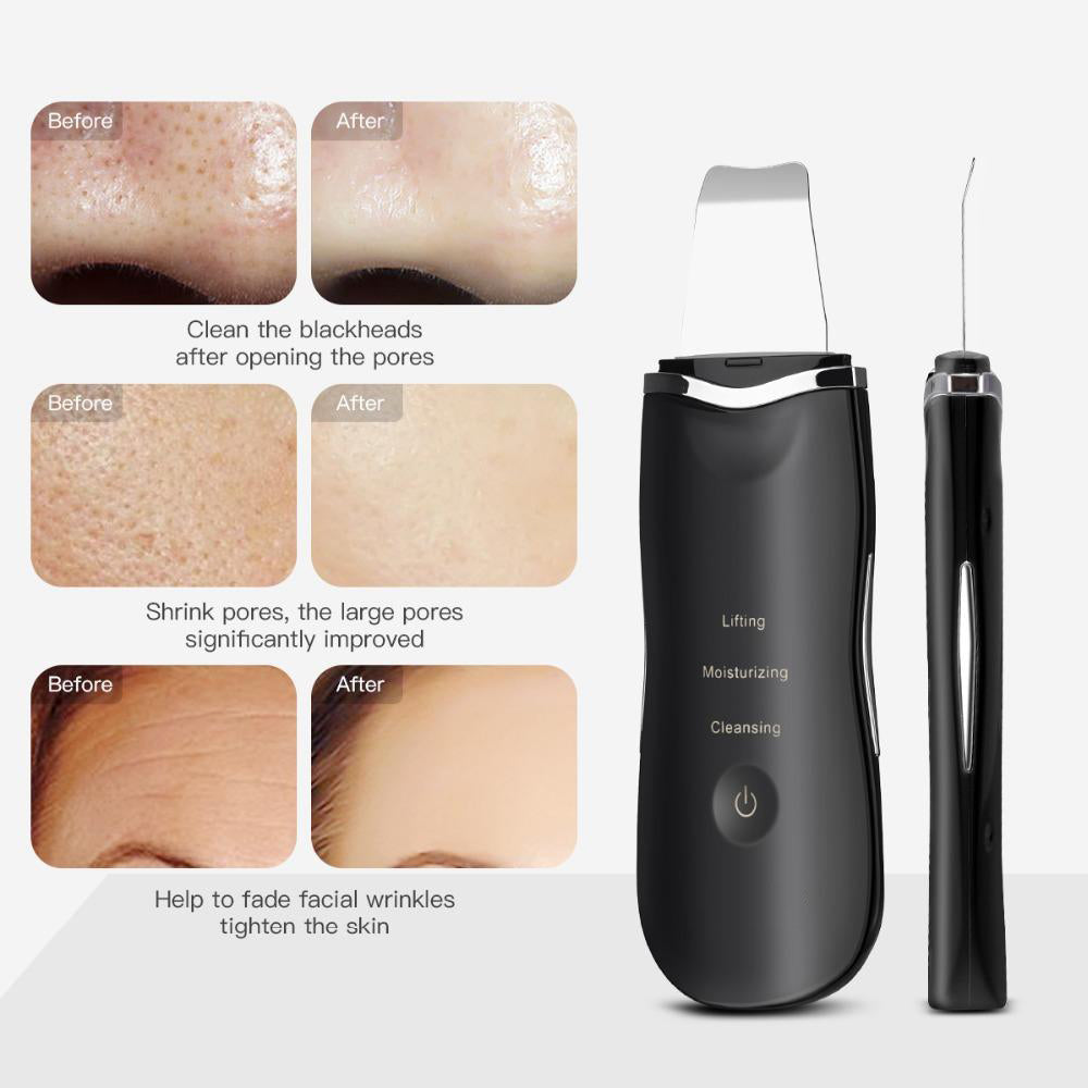Ionic Ultrasonic Facial Skin Scrubber