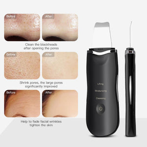 Ionic Ultrasonic Facial Skin Scrubber