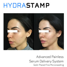 Load image into Gallery viewer, [Serum Pack] HYDRASTAMP DIY Derma EZ Jet EGF Stem Cell  (For Uneven Skin Texture, Pores and Scars)